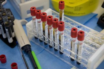 Centro prelievi di Corteolona - avviso agli utenti